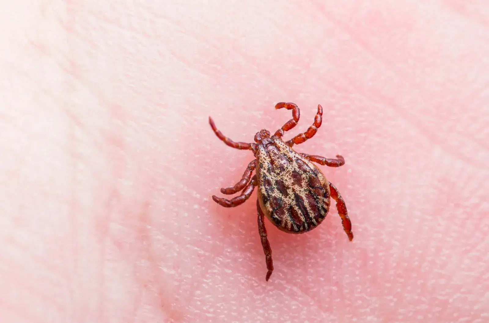 lyme disease Encephalitis Virus tick stock getty