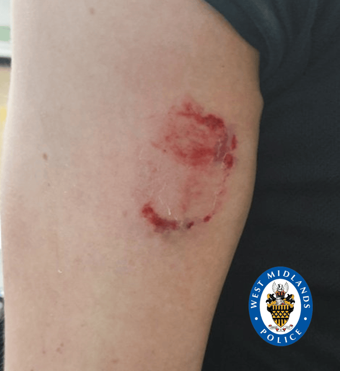 Woman Jailed After Biting Police Officer Minutes Into The New Year ...