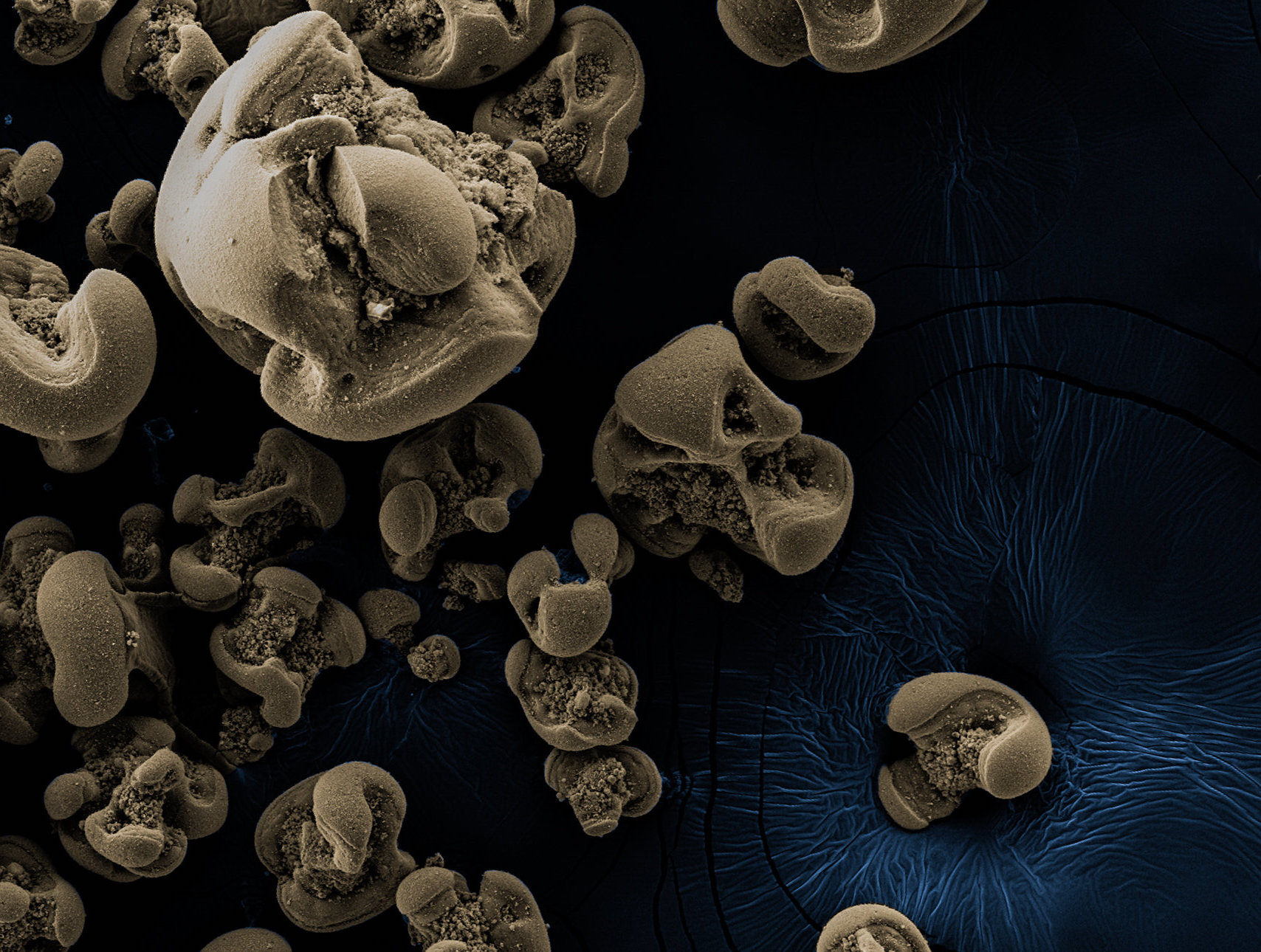 Bacteria That Feeds on Metal Accidentally Discovered by Scientists