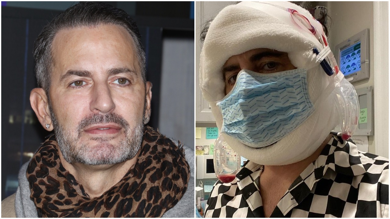 Marc Jacobs Reveals He's Had a Facelift As He Shares Bandaged