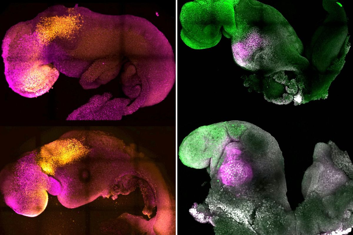 Lab Creates 'Synthetic' Embryo With Brain, Beating Heart - Newsweek