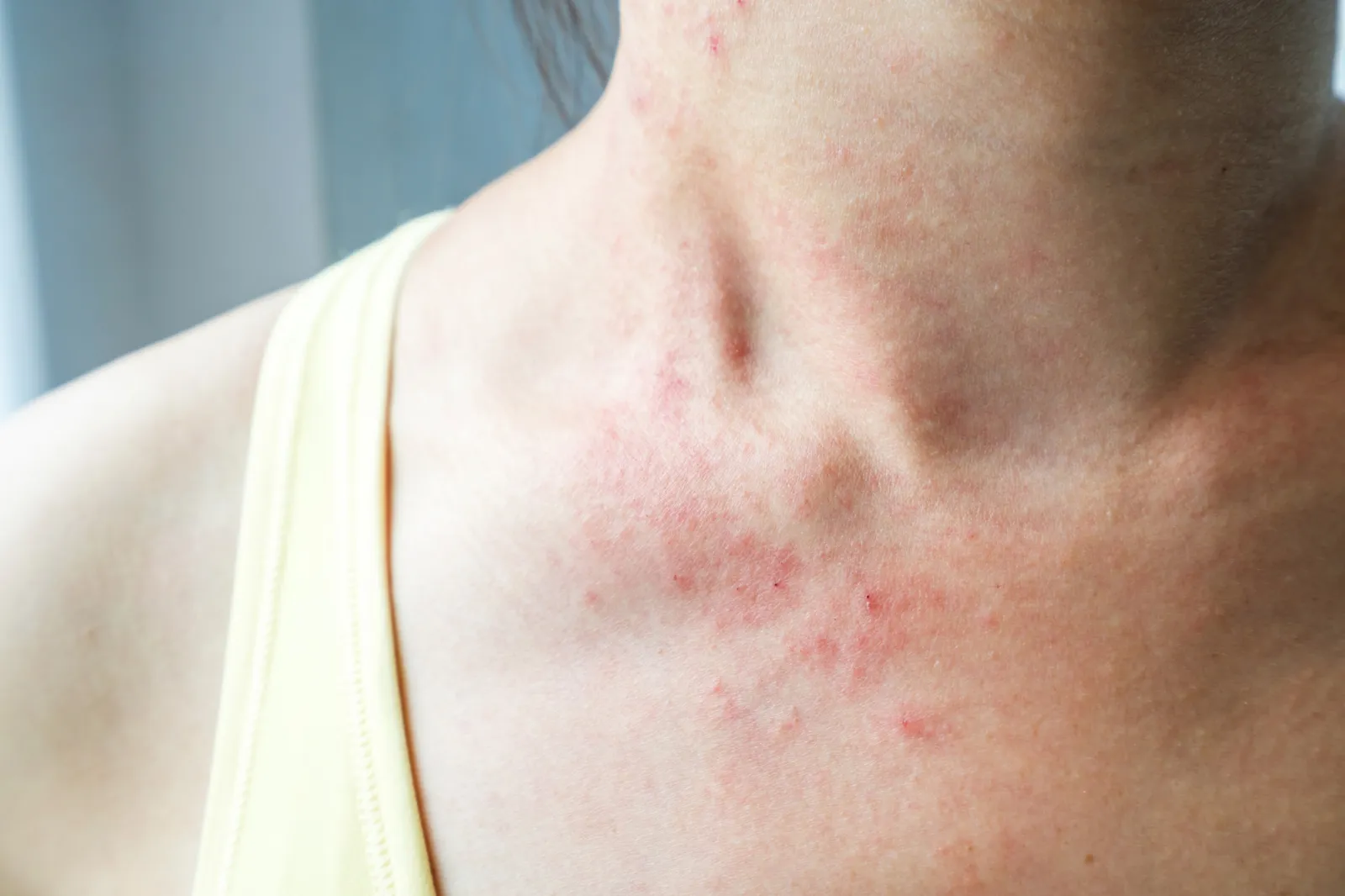 Dermatologists Reveal the Health Secrets Hidden in Your Skin - Newsweek