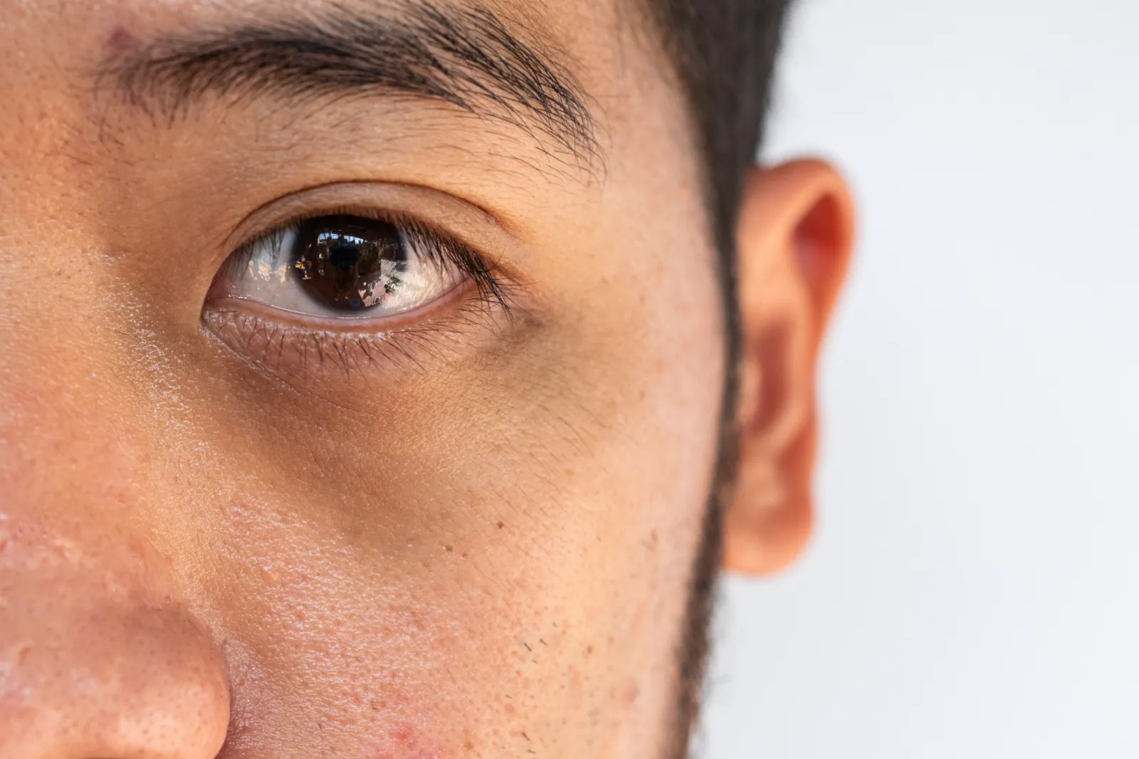 does smoking cigarettes cause dark circles under your eyes How affect eye bags and circles? Smoking, a habit fraught with a multitude of adverse health effects, significantly impacts the appearance of under-eye bags and may How to Get Rid of