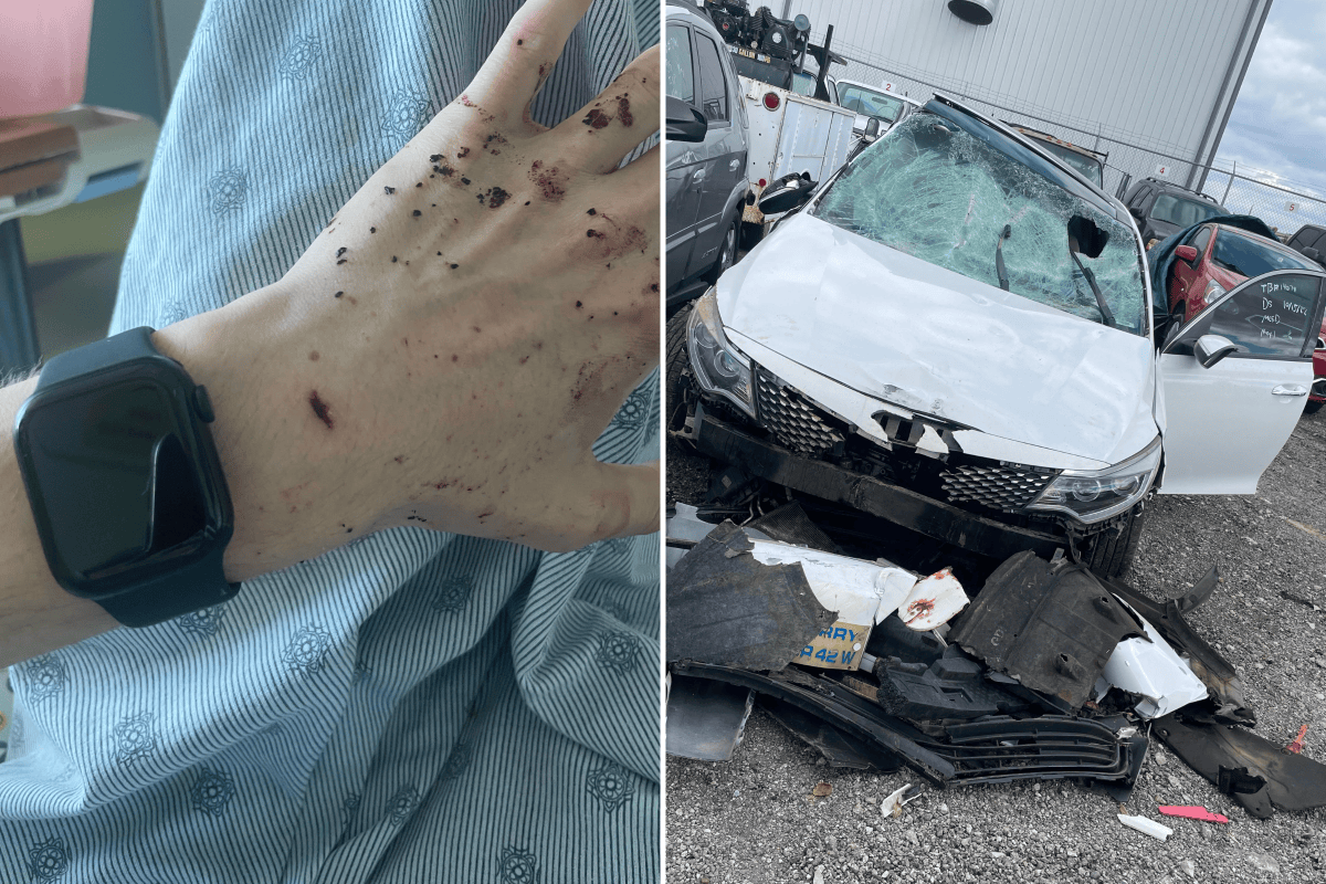 Man in ‘Life or Death’ 70mph Car Crash Credits Apple Watch for Saving ...