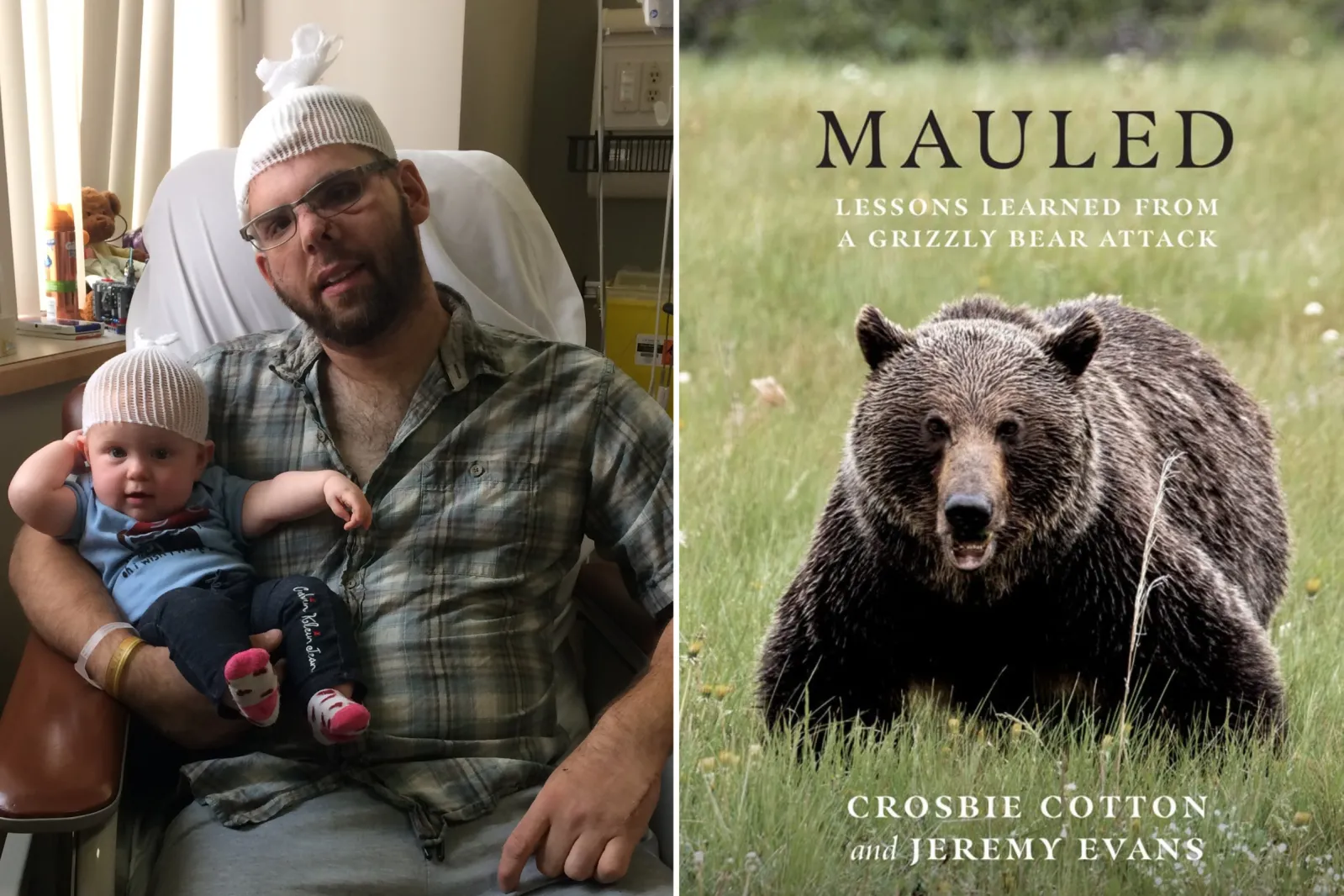 Man Who Escaped After Bear Crushed His Skull on How He Survived, image size:1599x1066