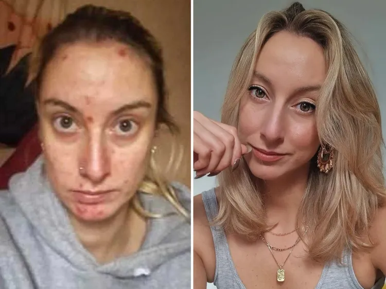 Woman Looks Unrecognizable After Going Teetotal and Beating Crack ...