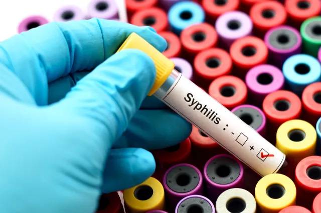 Why Syphilis Is on the Rise