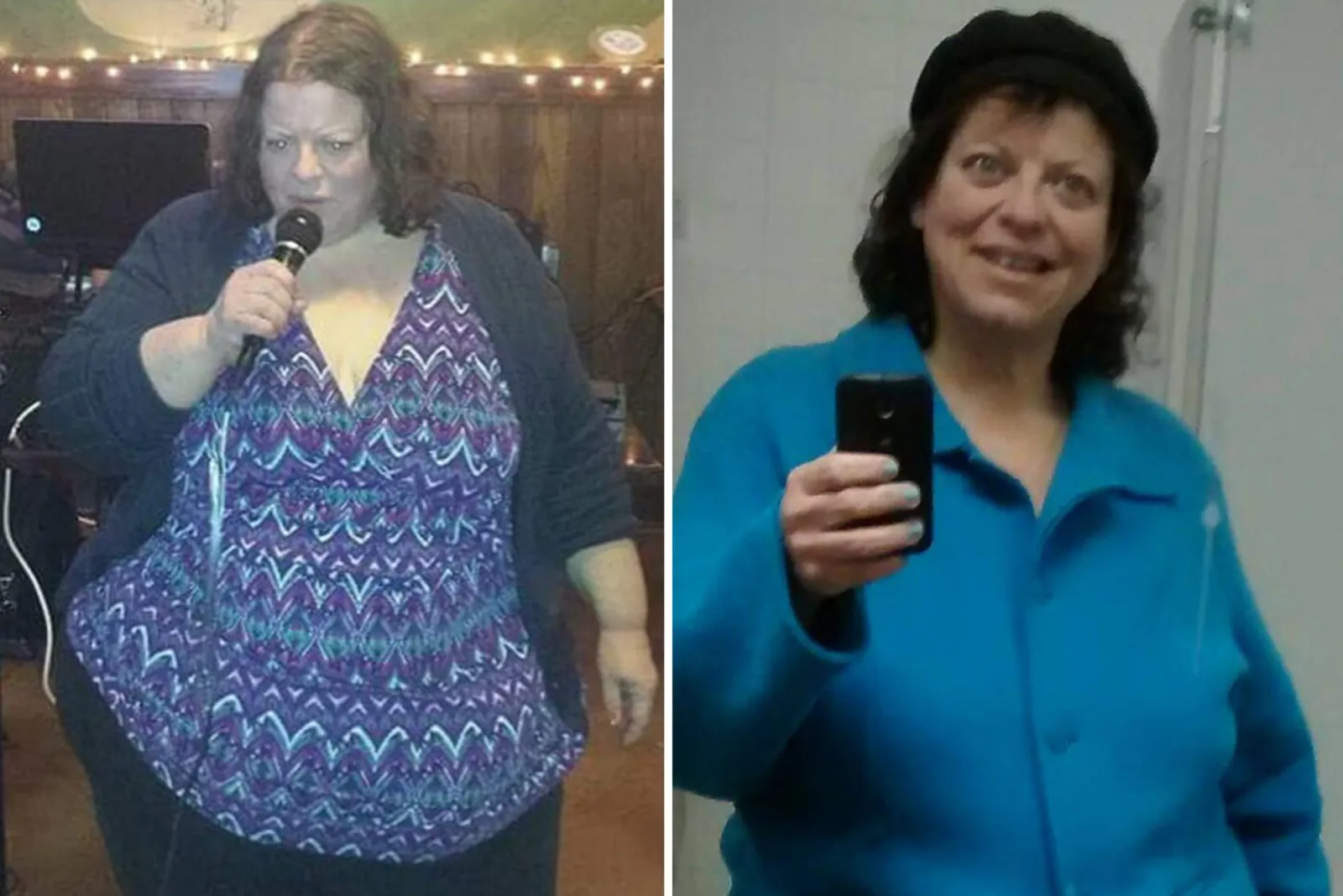 2.5 semaglutide Semaglutide Medication for Weight Loss Management