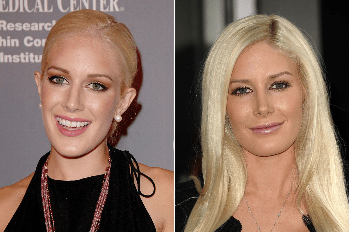 Heidi Montag Plastic Surgery Before and After Photos: Why She Almost ...