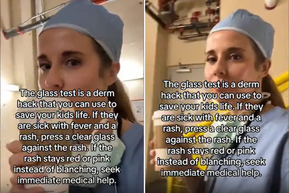 Dermatologist Explains Why Simple ‘Glass Test’ May Save a Child’s Life ...