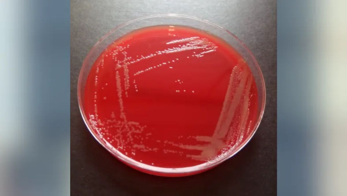 2338043-new-bacteria-species.