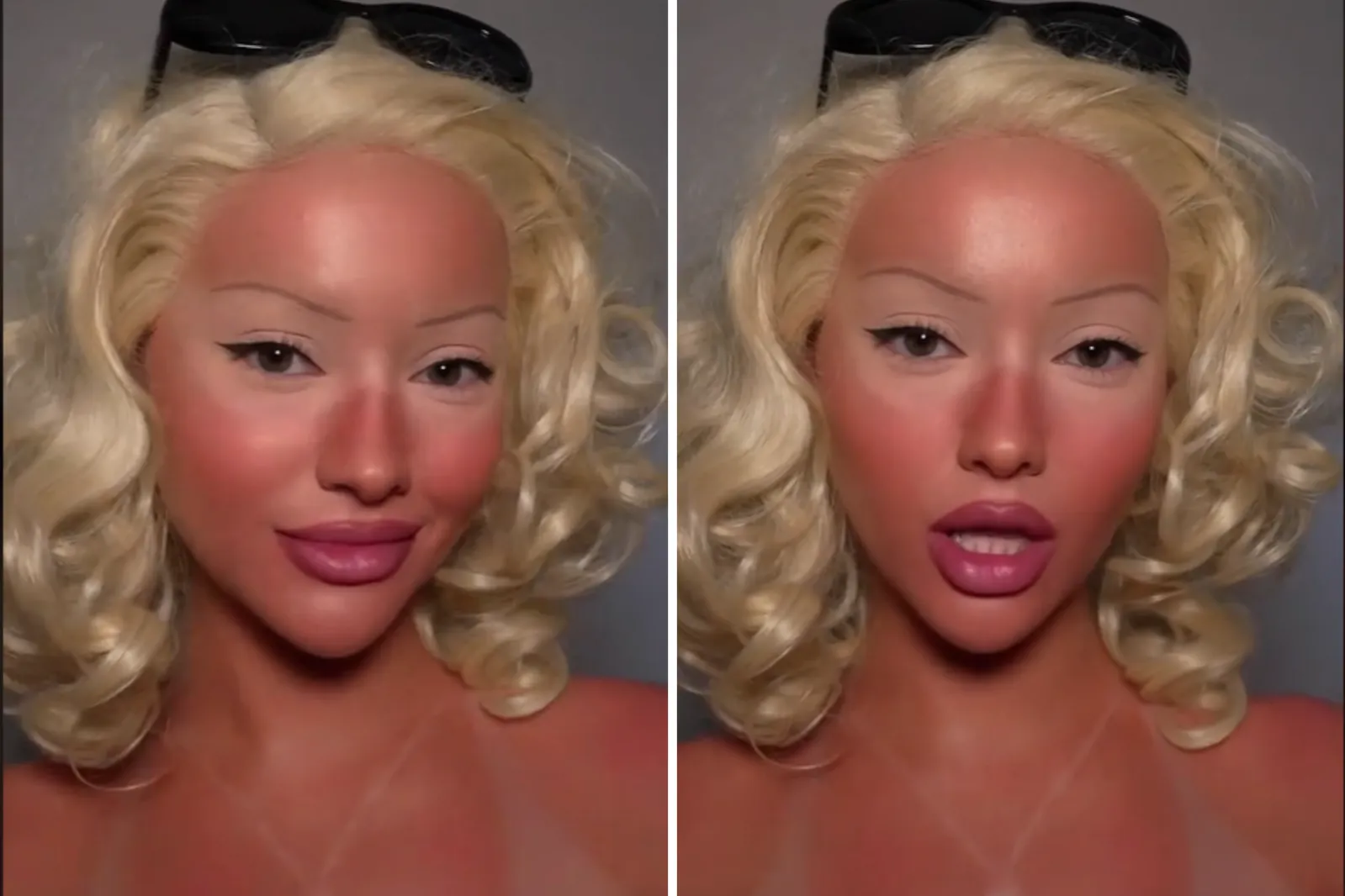 Isabel Rose Sunburn Makeup Trend
