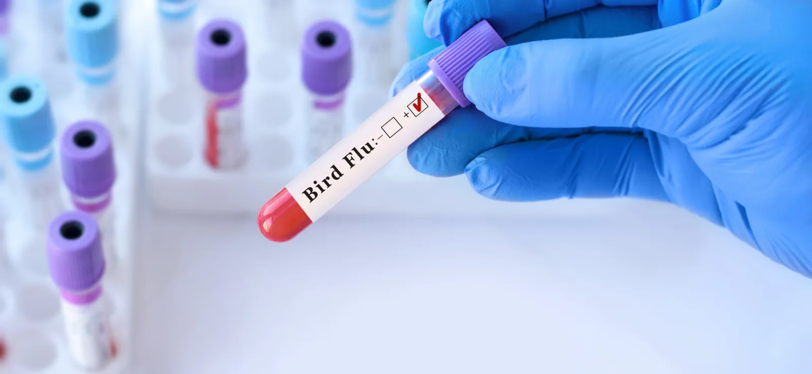 Bird Flu Map Update as US Cases Rise to 14 - Newsweek