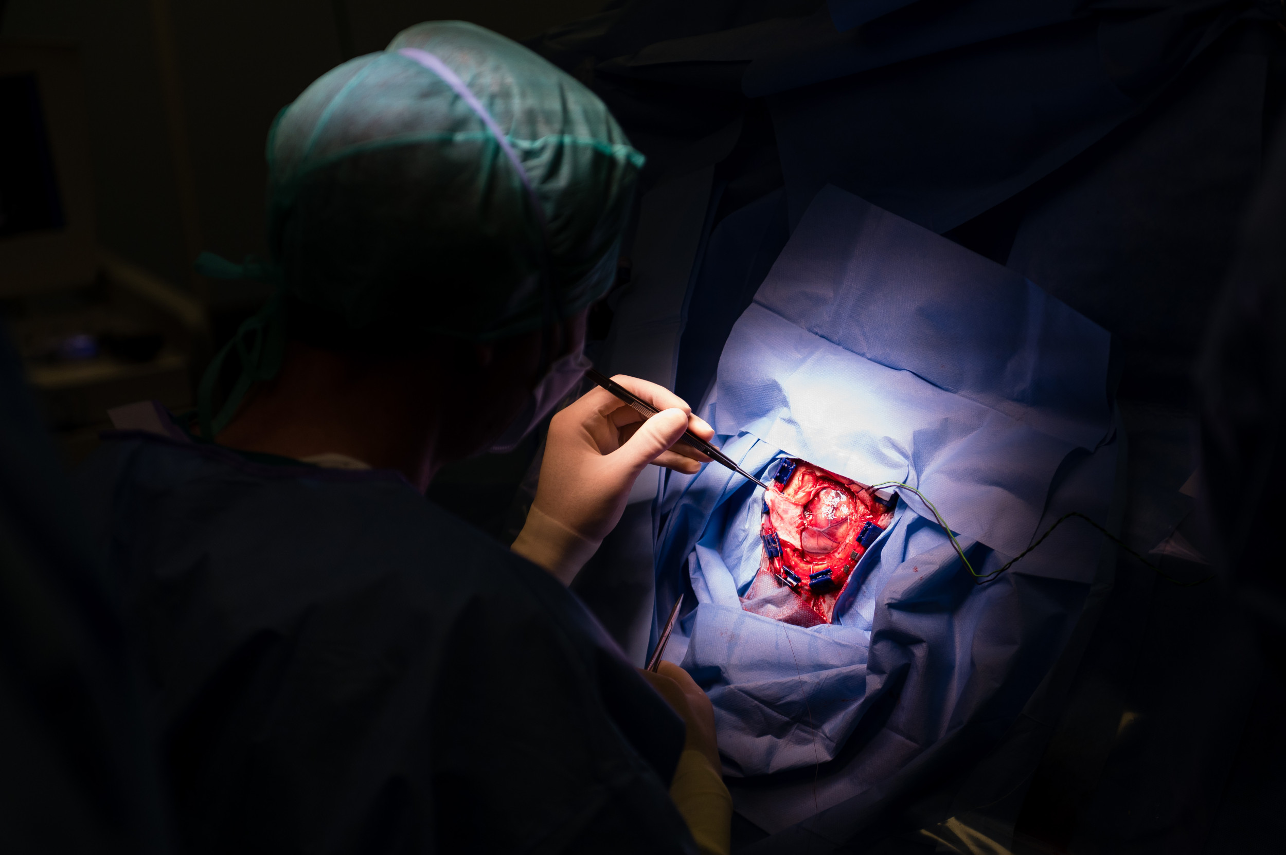 2484125-brain-surgery.jpg?w=