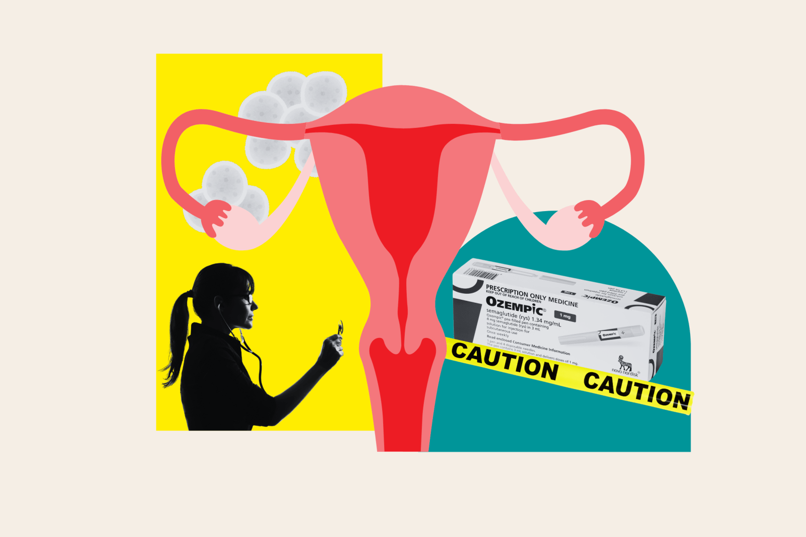 semaglutide cause yeast infection Gynecologist Reveals Ozempic's 'Unexpected' Effects on Your Vagina