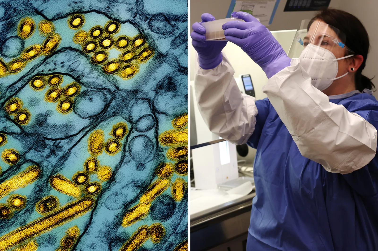 H5N1 Bird Flu Symptoms: What to Know After California Declares State of ...