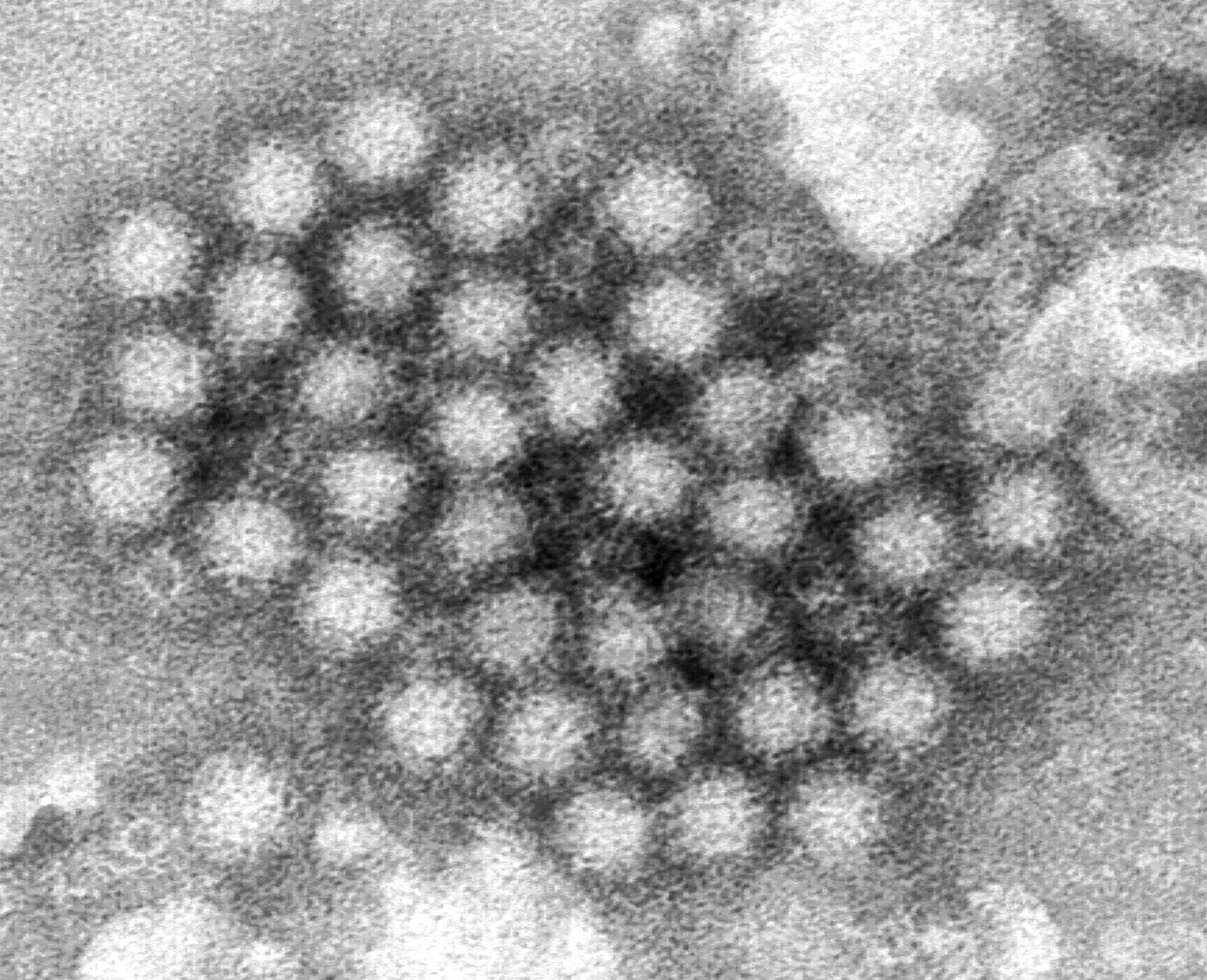 Norovirus Outbreaks: Public Health Official Warns of New Strain