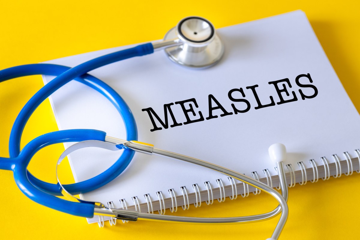 Mapa mostra surtos de sarampo aumentando nos Estados Unidos.