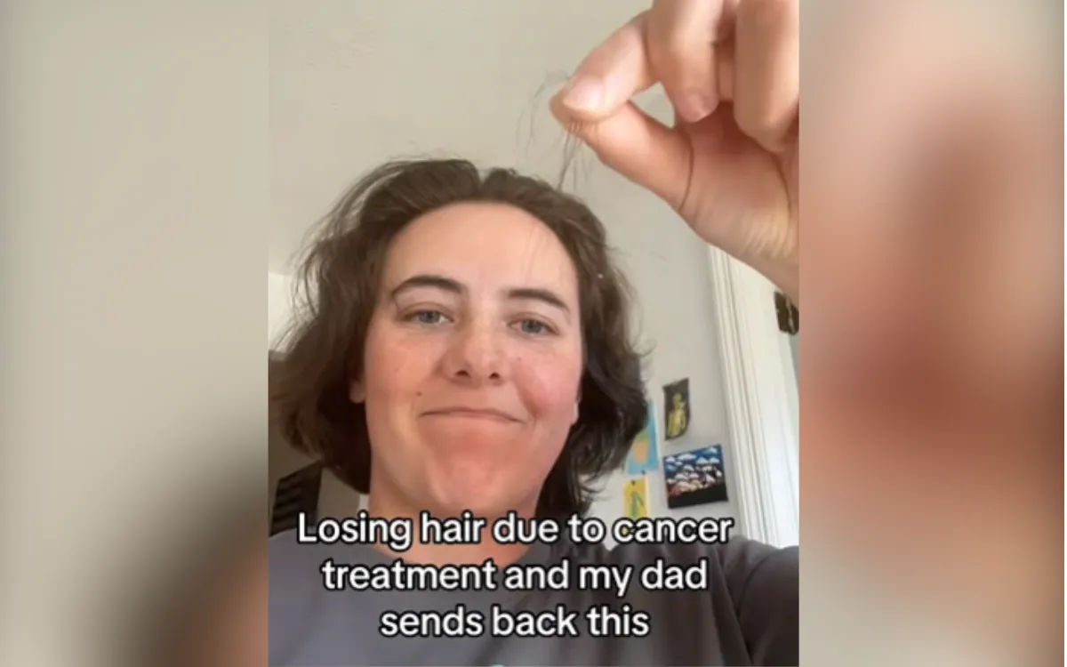 Gen Zer Losing Hair Due to Cancer Sends Dad Video, Can’t Believe His Reply
