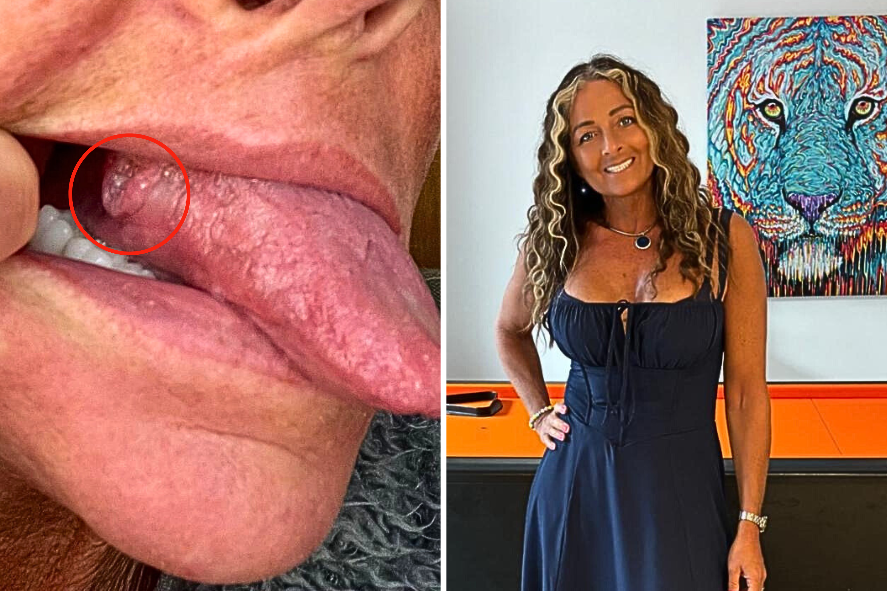 'I Thought I Bit My Tongue—Then Came the Shock Diagnosis'