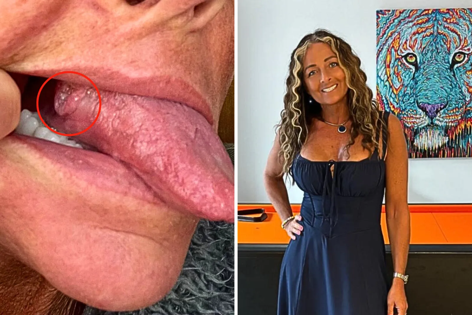 tongue bite tobacco I Thought I Bit My Tongue—Then Came the Shock Diagnosis'