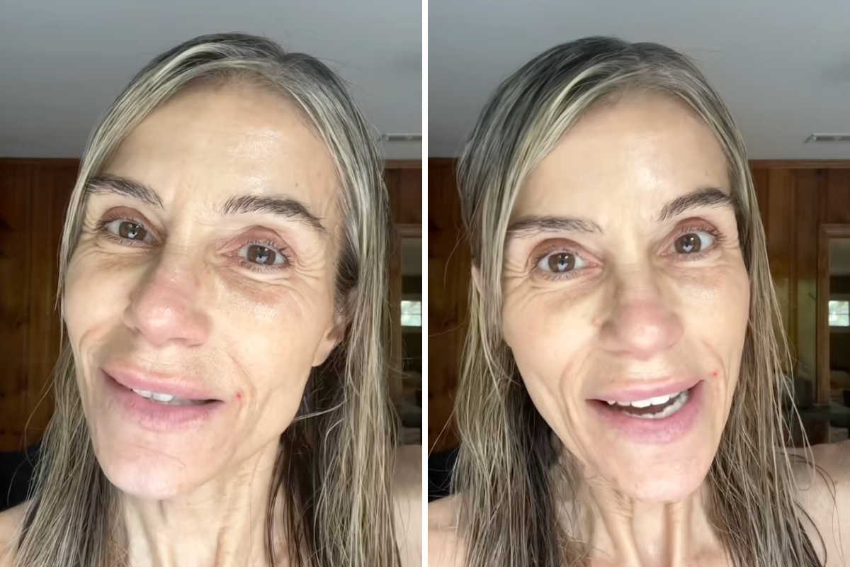 Woman, 59, Goes Botox-Free After Decades—Then Reveals Her Face - Newsweek