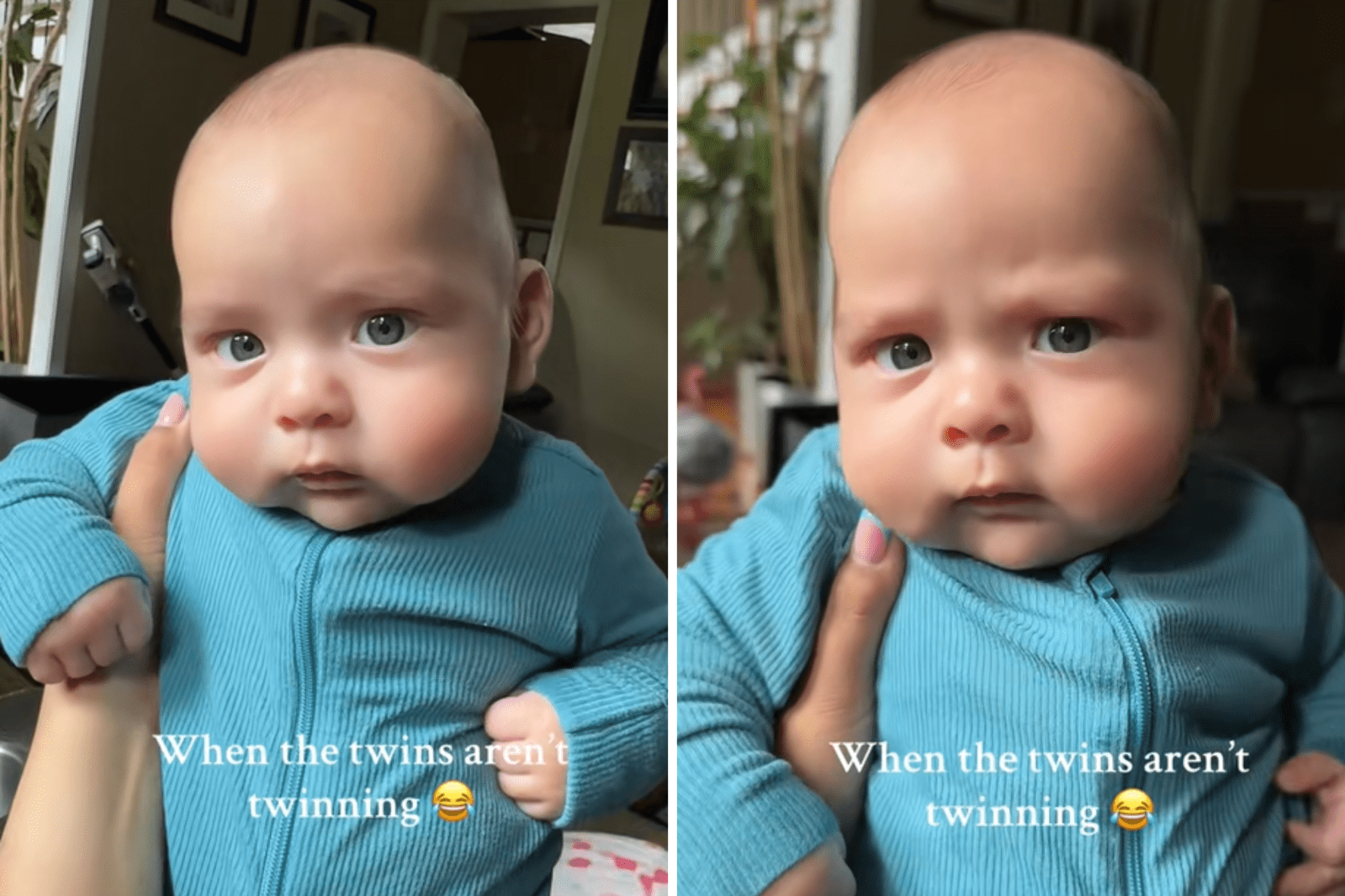 Mom Gives Birth to Twins, Unprepared for How They Look 4 Months