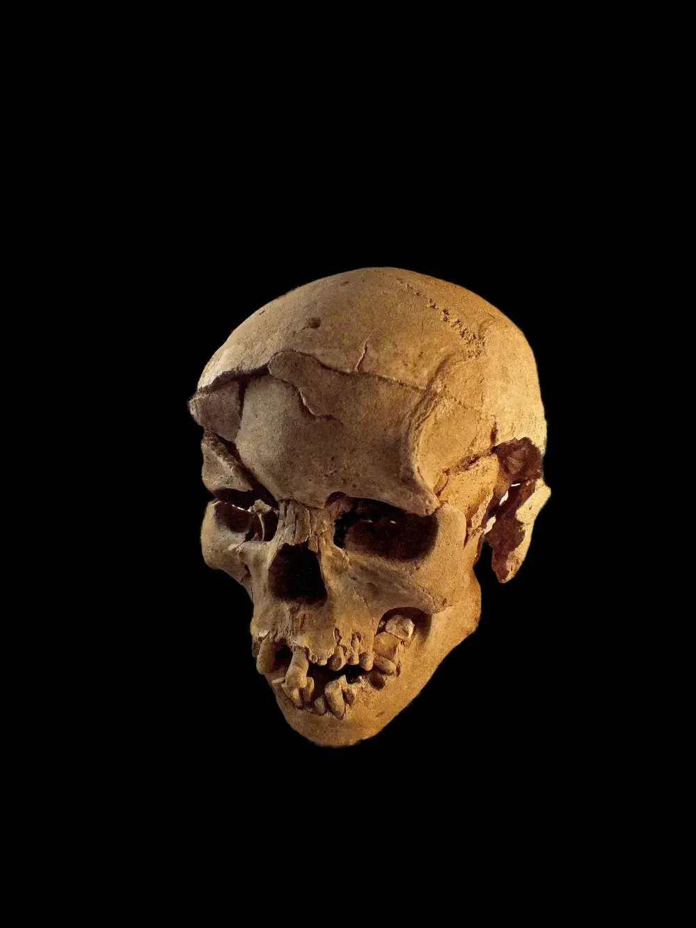 Evidence of Prehistoric Massacre May Indicate Warfare Among Hunter-Gatherers