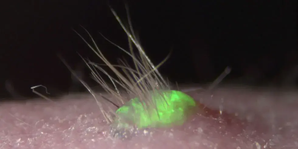 Artificial Skin that Grows Hair Could End Cosmetics Testing on Animals