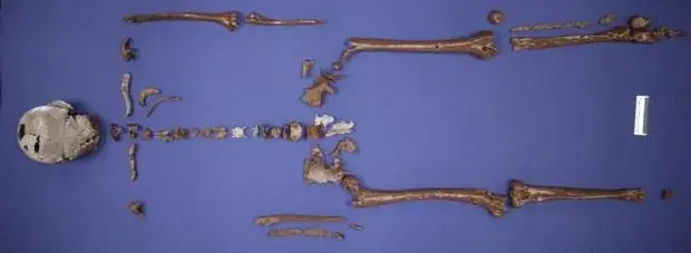 Ancient Skull of Viking King Gorm the Old Reconstructed With 3-D Printing