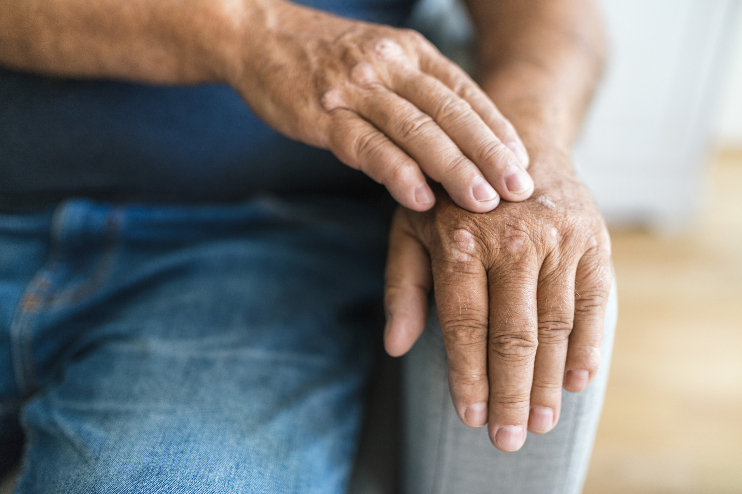 What You Need To Know About Arthritis, From Causes and Management to Emerging Treatment