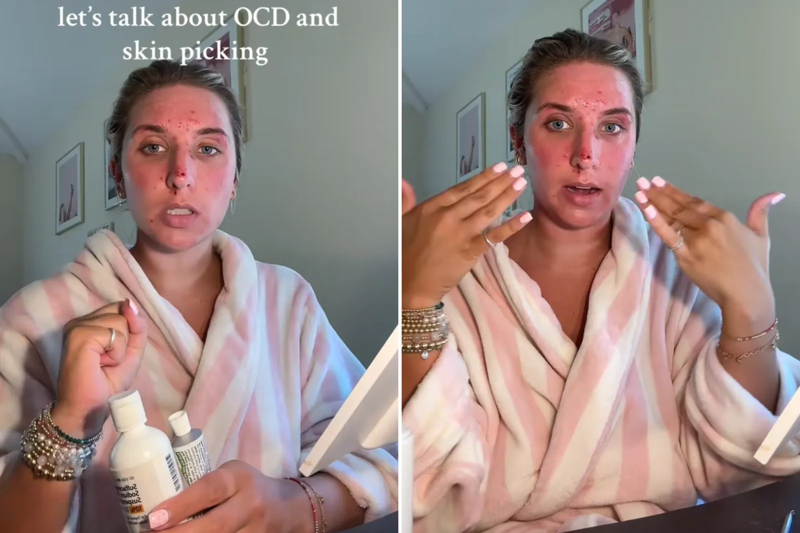 Woman Spends Hours Picking Skin, Then Comes Diagnosis