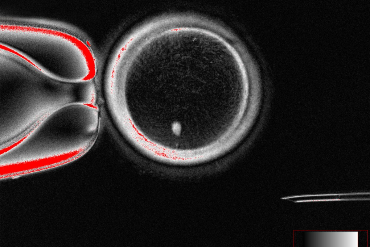 Breakthrough As Human Eggs Made From Skin Cells