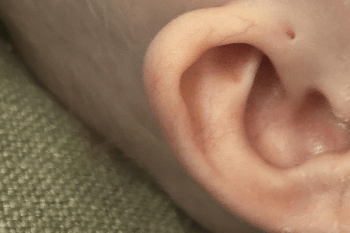 Baby Girl Born Healthy—Then Dad Notices Something ‘Strange’ About Her Ears