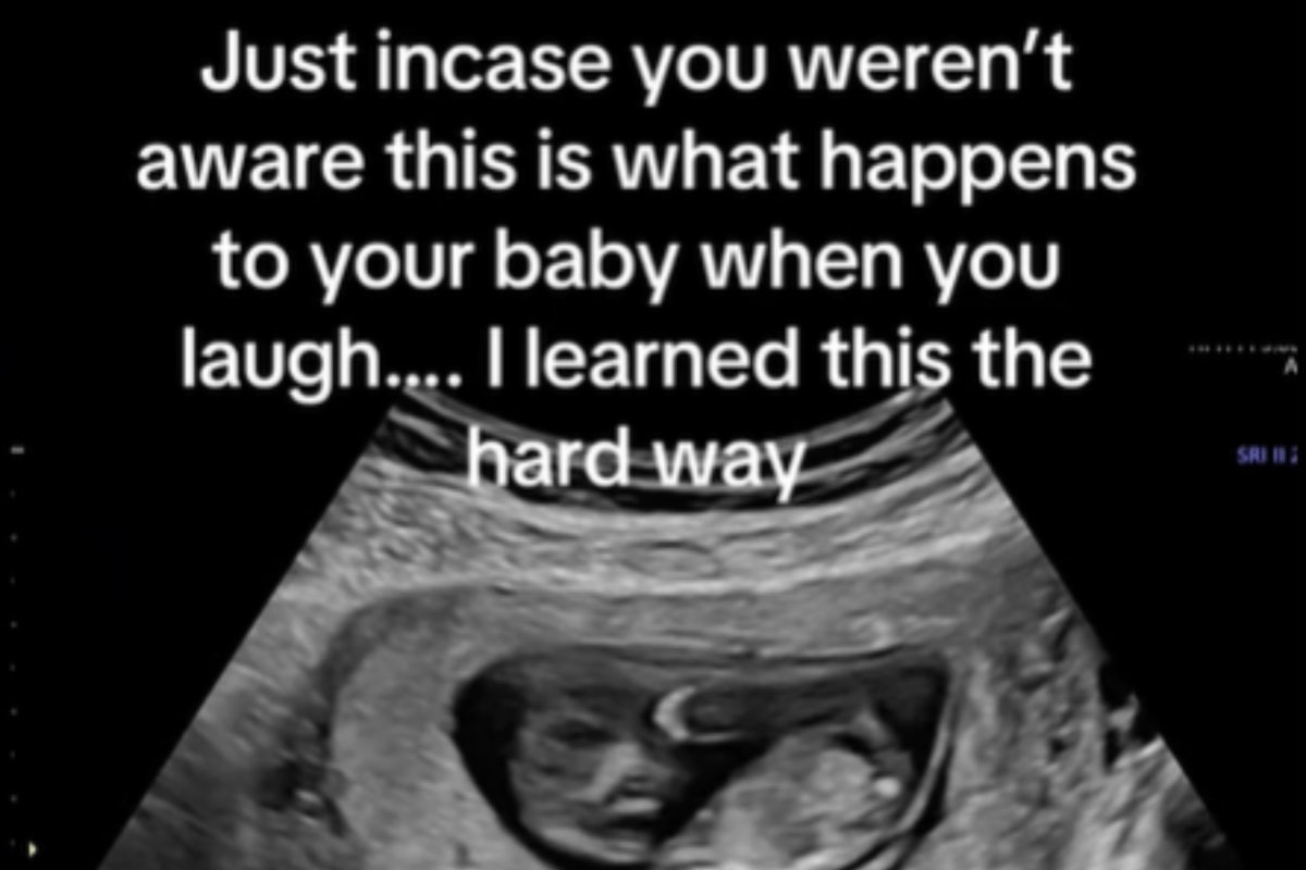 Ultrasound Captures What Happens to Unborn Baby When Mom Laughs