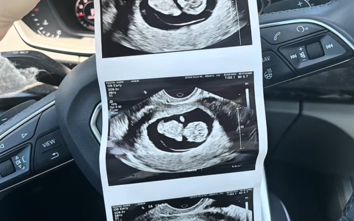 Pregnant Woman Goes For Ultrasound—‘Complete Shock’ At What Baby Is Missing