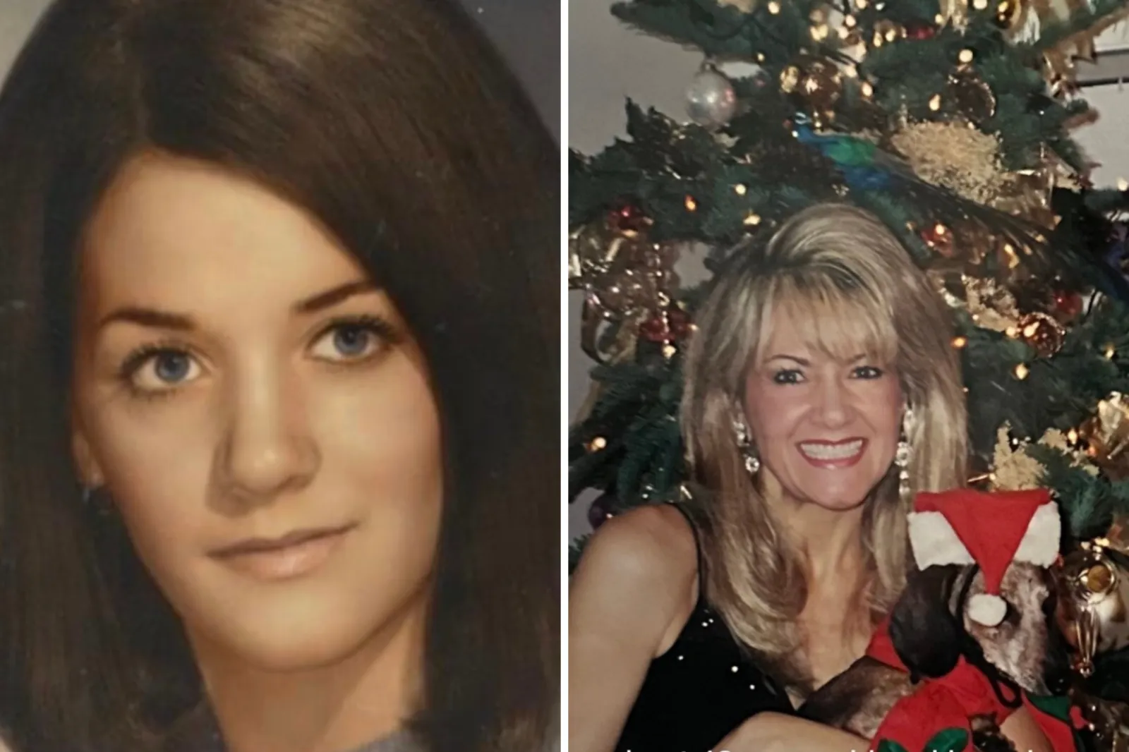 Woman’s Unfiltered Photos Before and After Facelift at 74 Go Viral