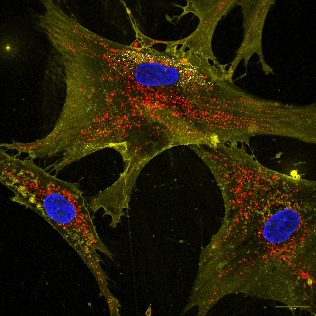 Microscopic image showing how nanoflowers (white) help healthy cells (yellow) deliver energy-producing mitochondria (red) to neighboring cells. Nuclei are stained blue. | Image: Courtesy of Dr. Akhilesh K. Gaharwar.