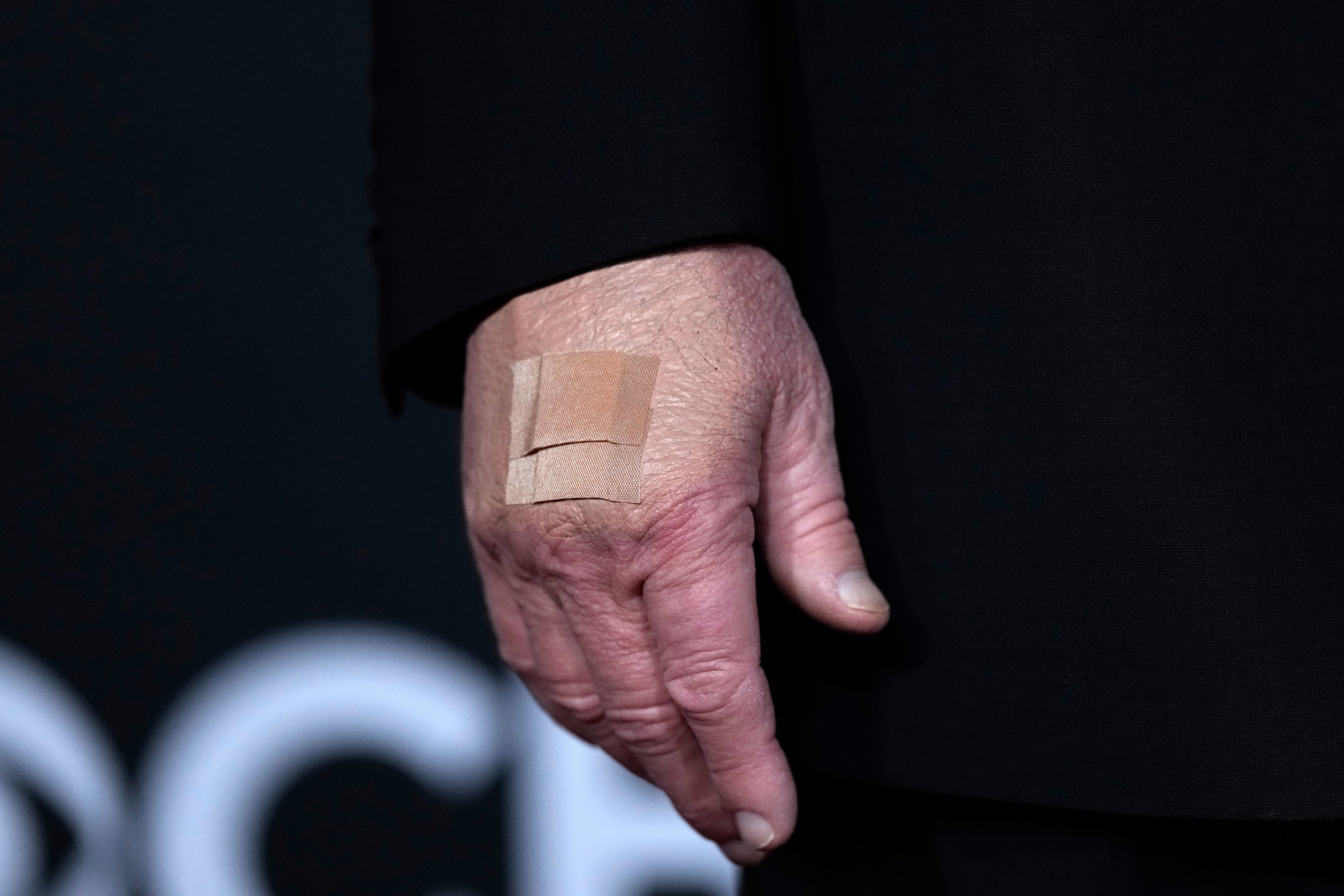 White House Speaks Out About Donald Trump's Hand Bandages