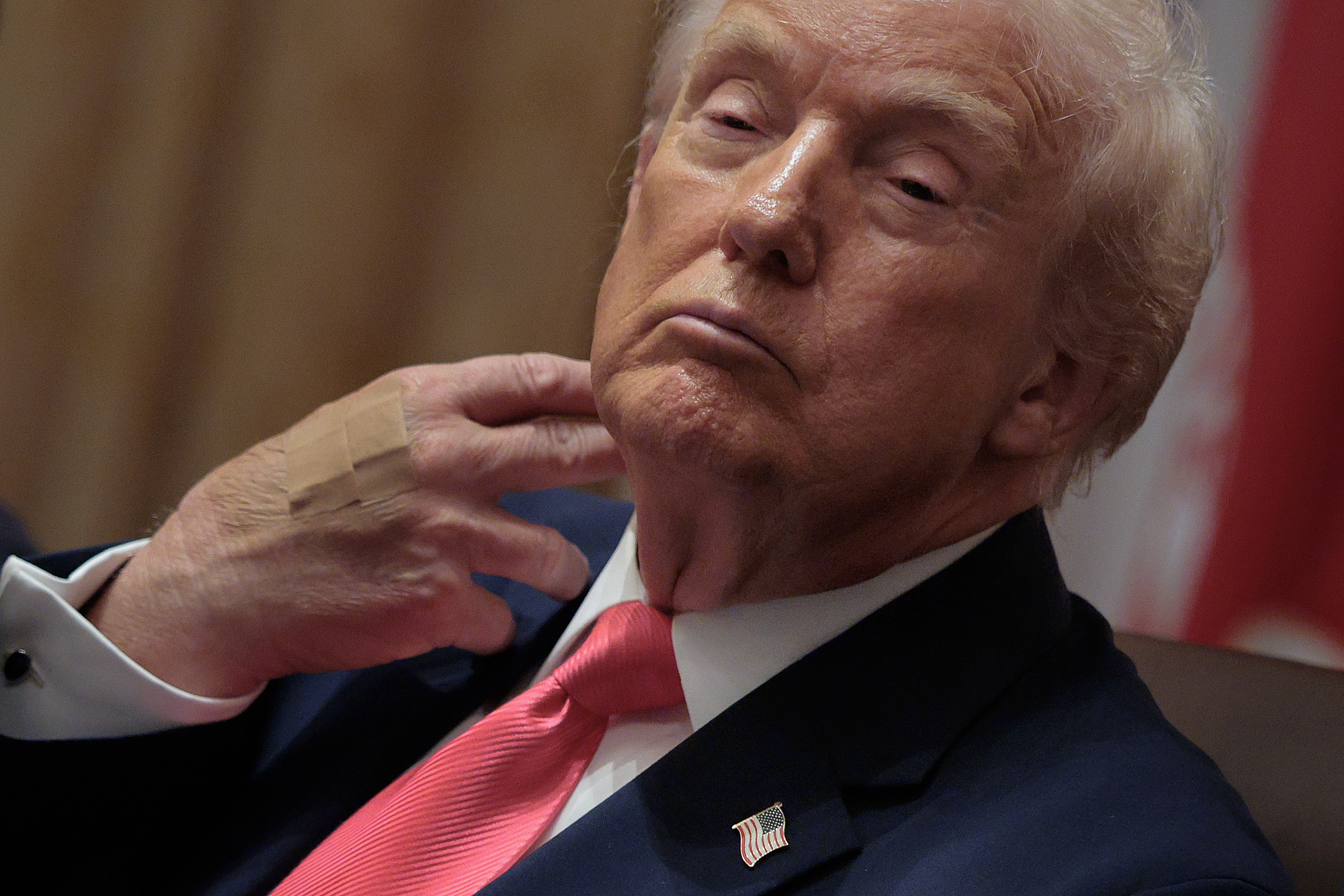 Donald Trump’s Bandaged Hand Comes Under Scrutiny