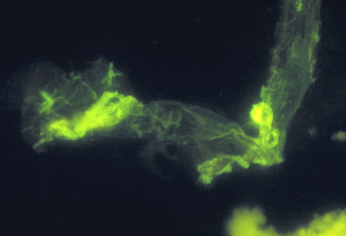 Over a Dozen Cases of Legionnaires&rsquo; Disease Possibly Linked to Florida Gym