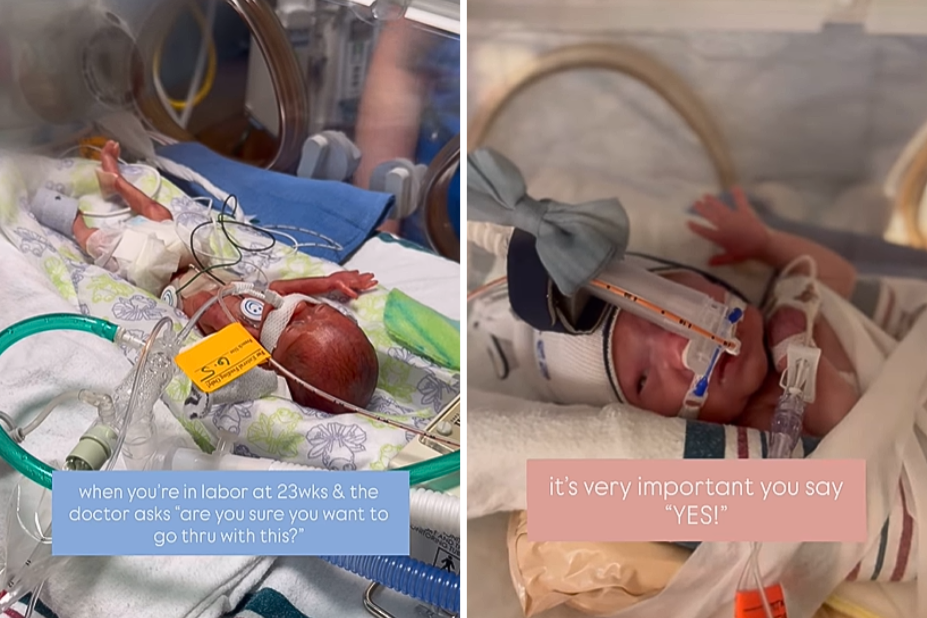 Mom Gives Birth at 23 Weeks to Daughter, Her Fight Changes Everything