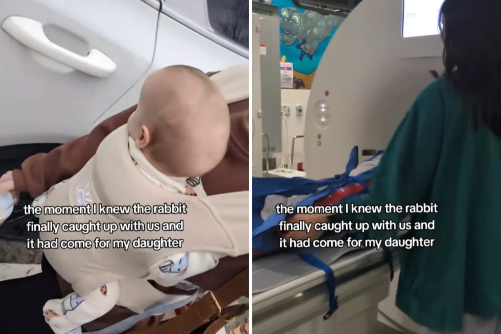 Mom Has Traumatic C-Section, 2 Weeks Later Notices Baby’s Head Isn’t Normal