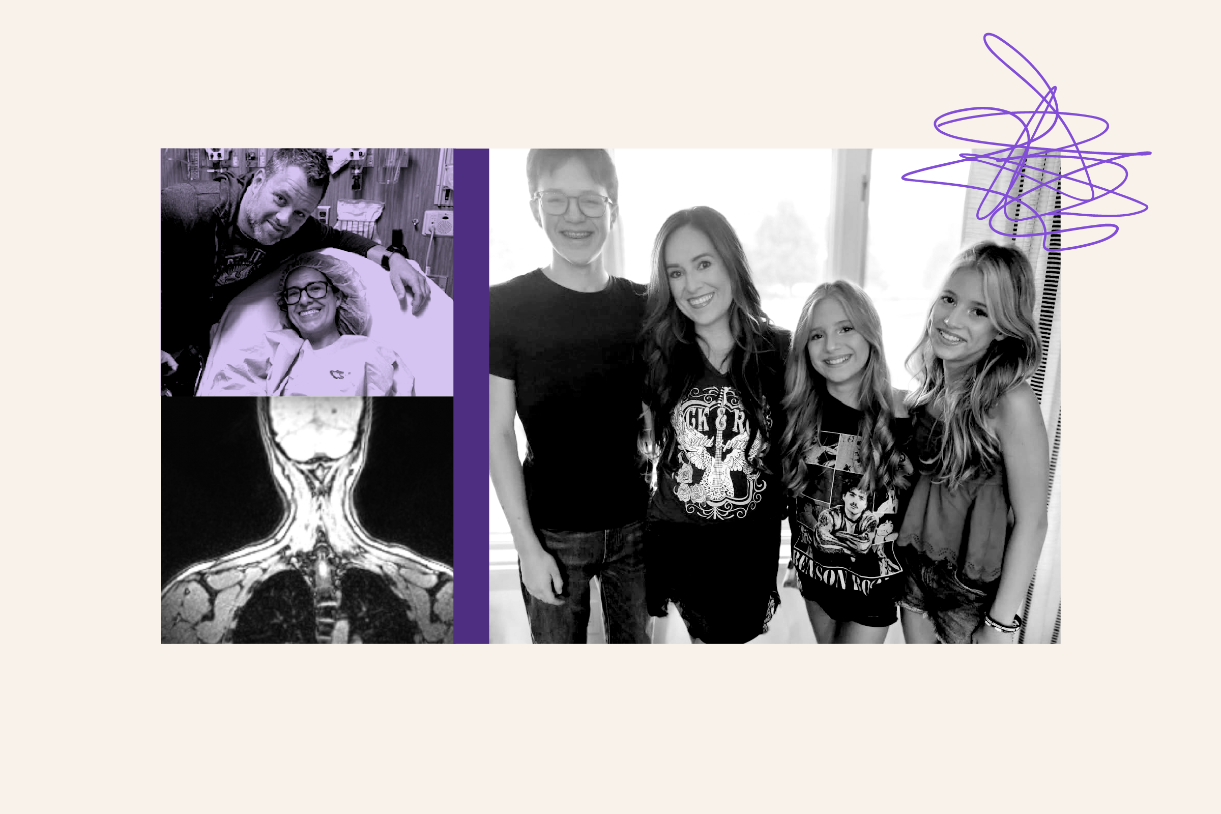 A Rare Cerebrospinal Fluid Leak Nearly Killed Me—This Was My First Symptom