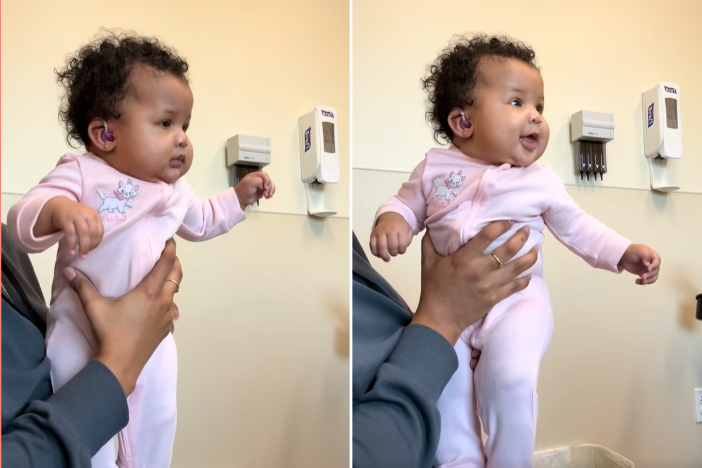 Baby Gets First Hearing Aids, Exact Moment She Hears Mom’s Voice Goes Viral