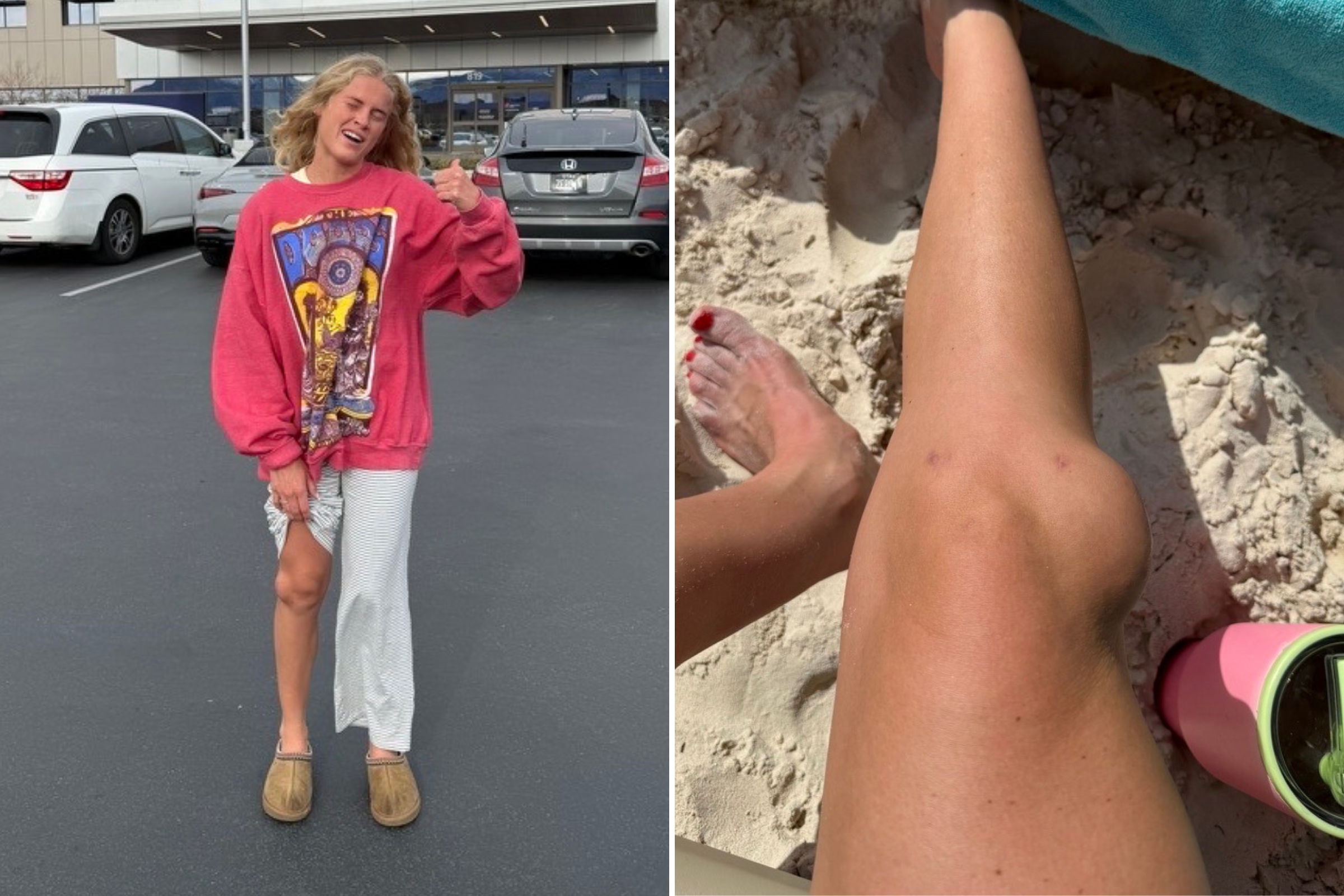 Woman Runs up to 5 Miles per Day, What Happens to Knee Horrifies Viewers