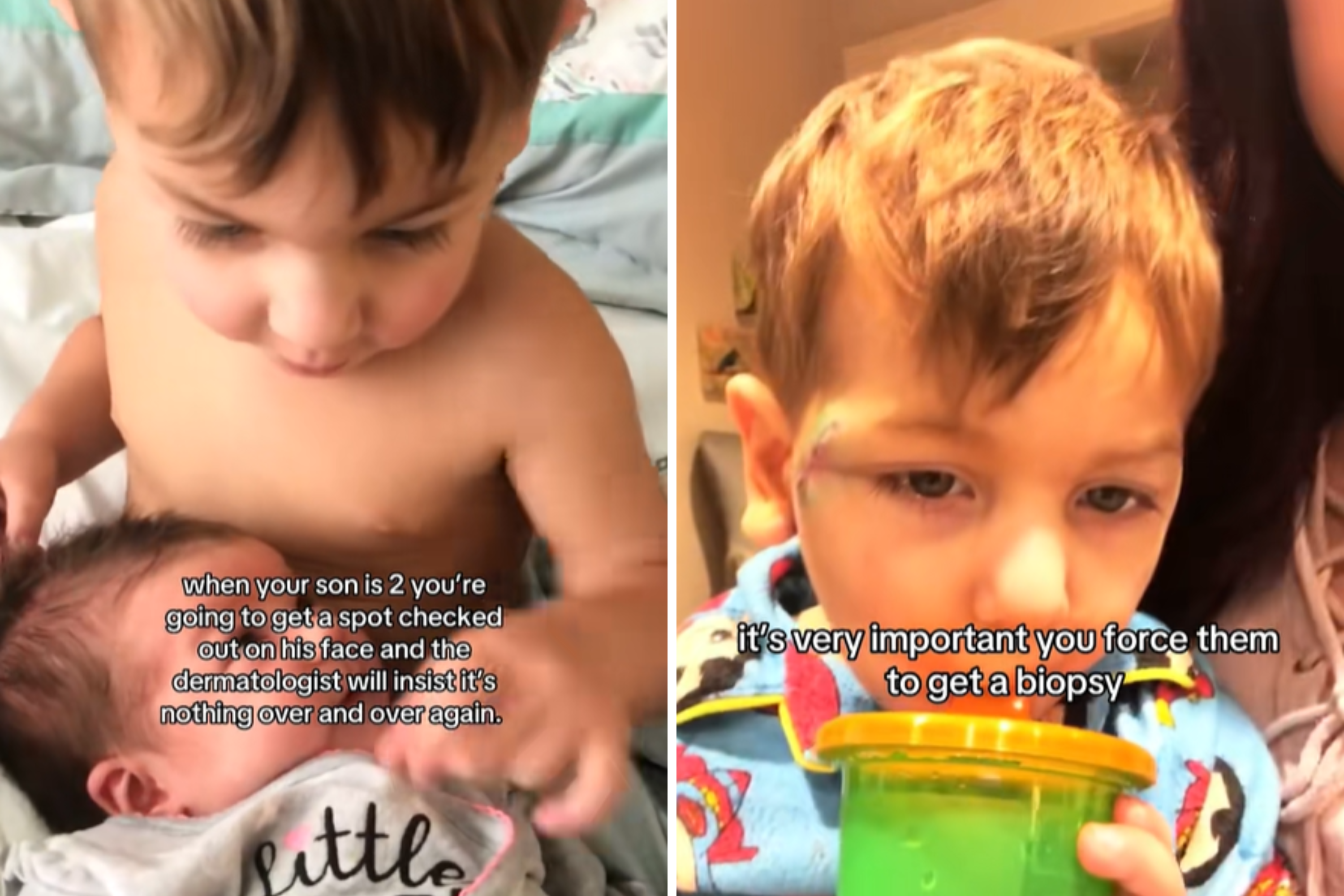 I Noticed a Spot on My Toddler’s Face, Trusting My Instincts Saved His Life