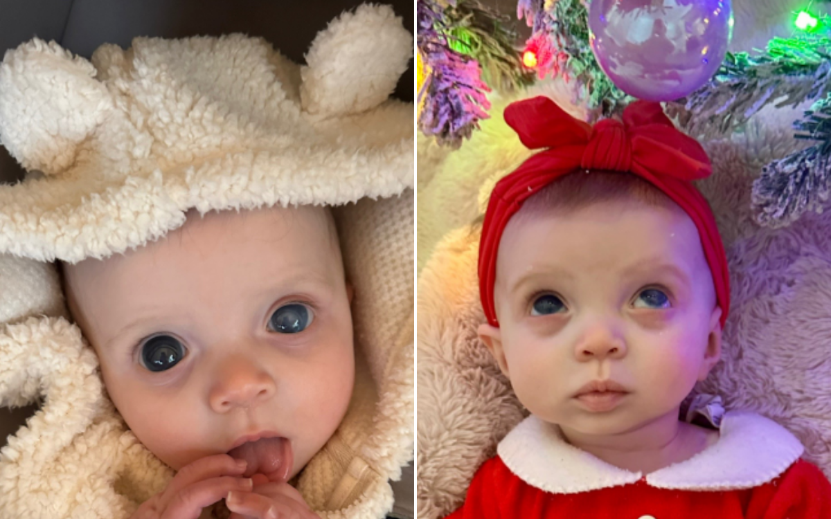 Baby Girl Born With Most Beautiful Eyes, Then Came ‘Terrifying’ Diagnosis Baby Girl Born With Most Beautiful Eyes, Then Came ‘Terrifying’ Diagnosis