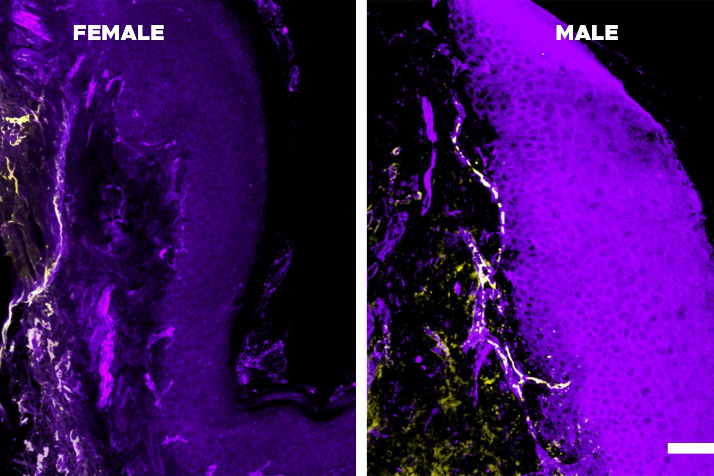 Scientists Prove Women's Pain Does Last Longer Than Men's