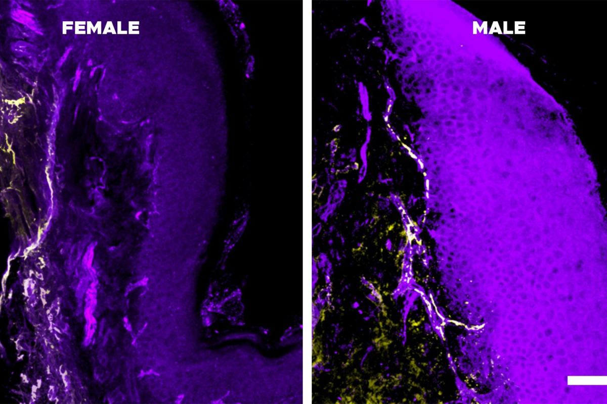 Scientists Prove Women’s Pain Does Last Longer Than Men’s